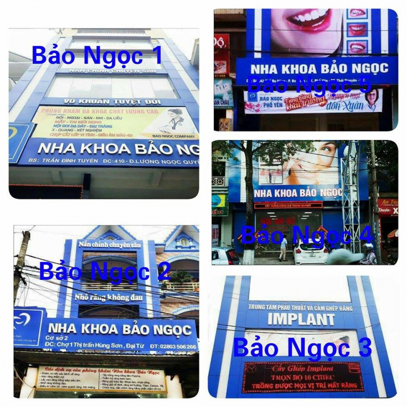 Hàn răng (trám răng) như thế nào?