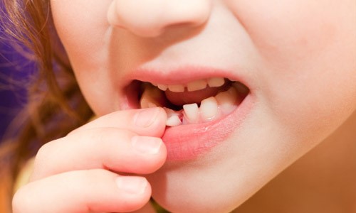 Những điều cần biết khi nhổ răng