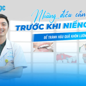 Những điều cần biết trước khi niềng răng