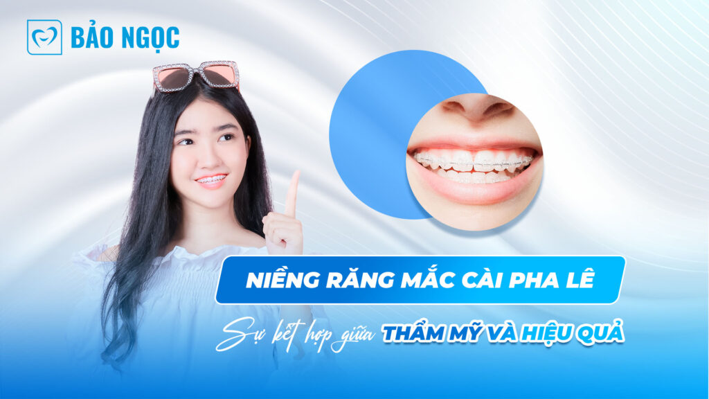 Niềng răng mắc cài pha lê