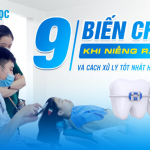 biến chứng khi niềng răng