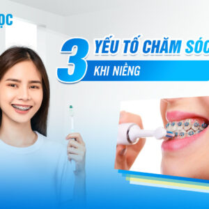 Chăm sóc răng miệng khi niềng