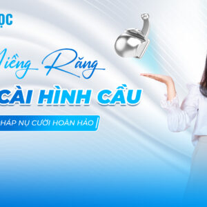 Mắc cài hình cầu