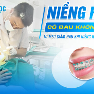 Niềng răng có đau không