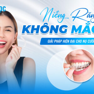 niềng răng không mắc cài