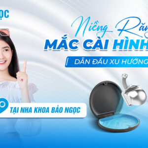 niềng răng mắc cài hình cầu