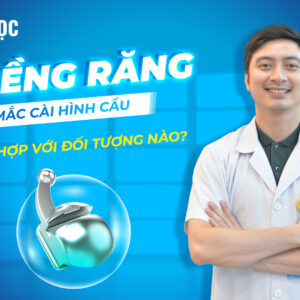 Niềng răng mắc cài hinh cầu kim loại