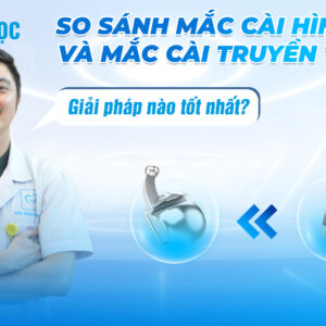 So sánh mắc cài hình cầu