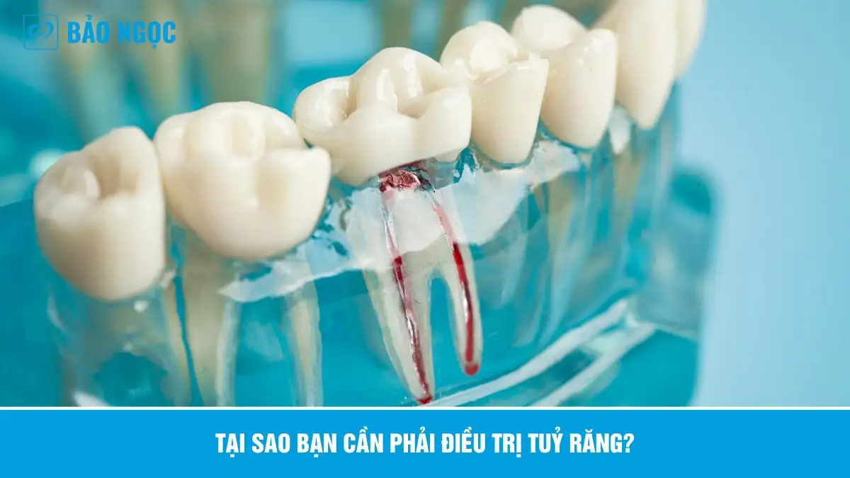 Điều Trị Tủy